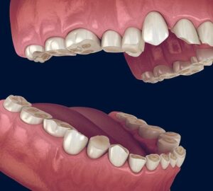 Okluzja w kosmetyce – klucz do zdrowej i pięknej skóry