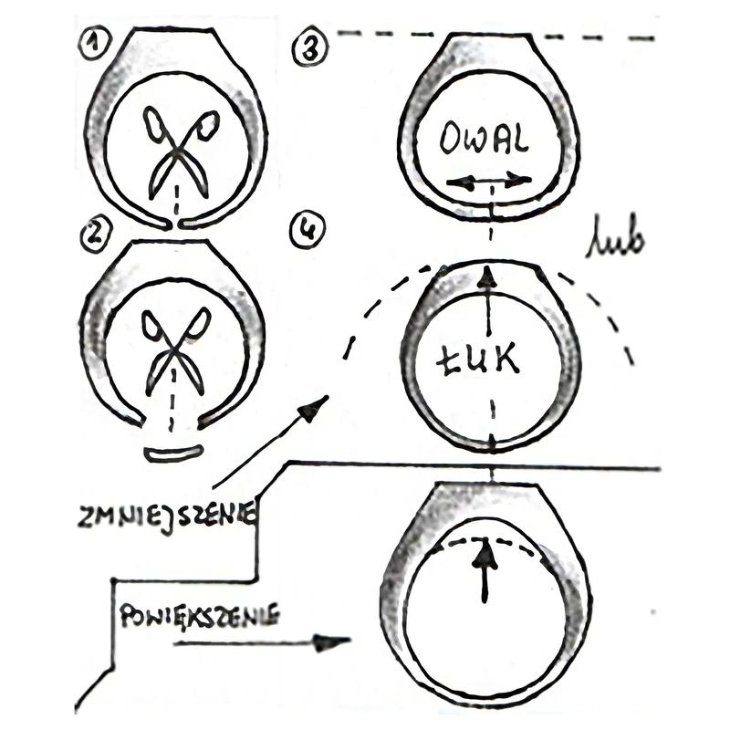 Jakie czynniki wpływają na to, ile kosztuje powiększenie pierścionka?