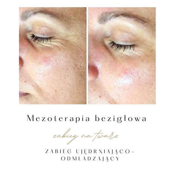 Nowoczesne technologie w pielęgnacji