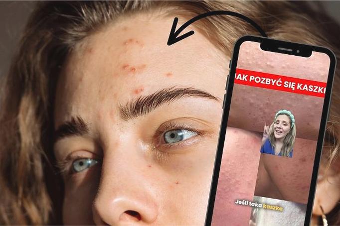 Pielęgnacja wrażliwej skóry